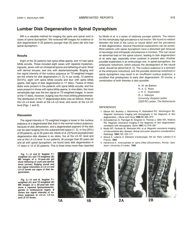 PDF extract preview