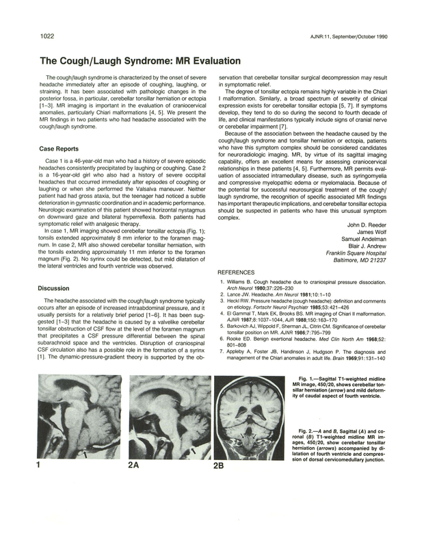 PDF extract preview