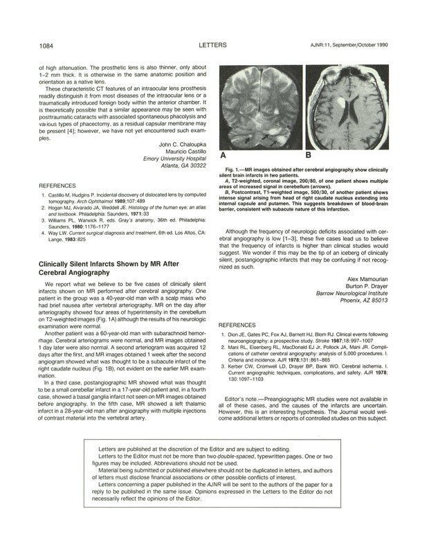 PDF extract preview