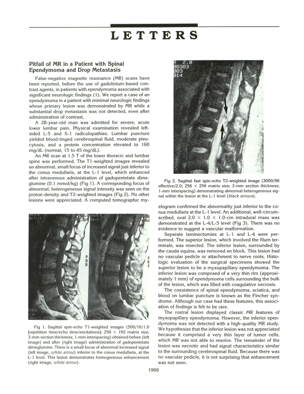 PDF extract preview