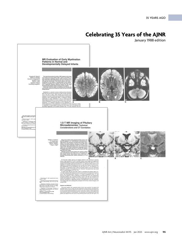 PDF extract preview