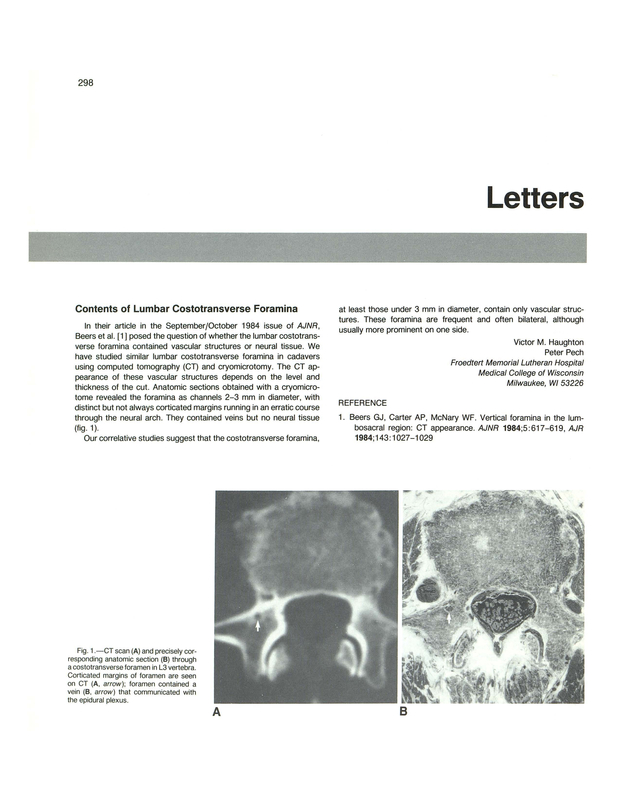 PDF extract preview