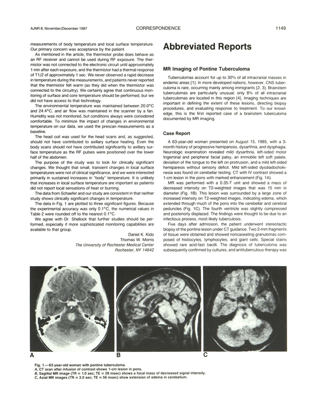 PDF extract preview