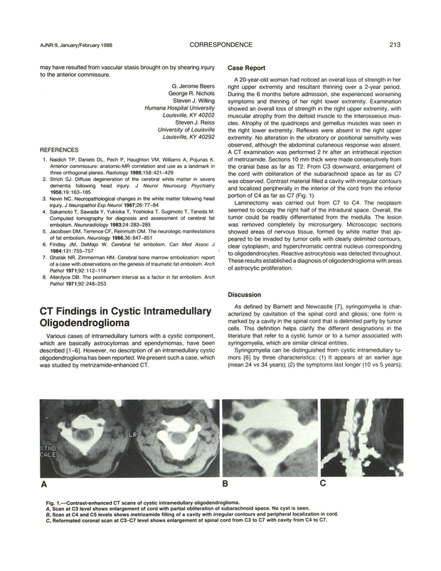 PDF extract preview