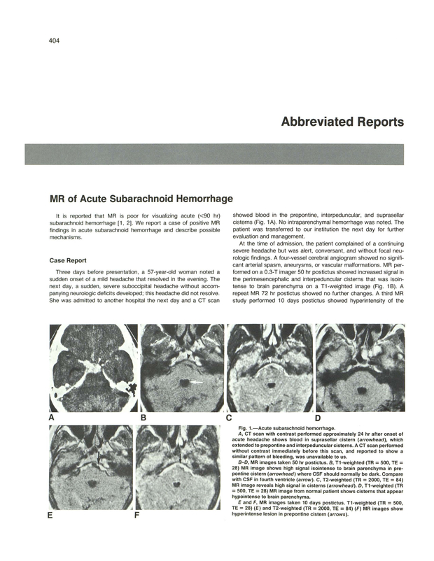 PDF extract preview