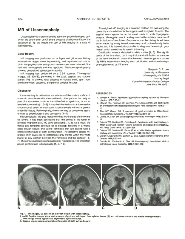 PDF extract preview