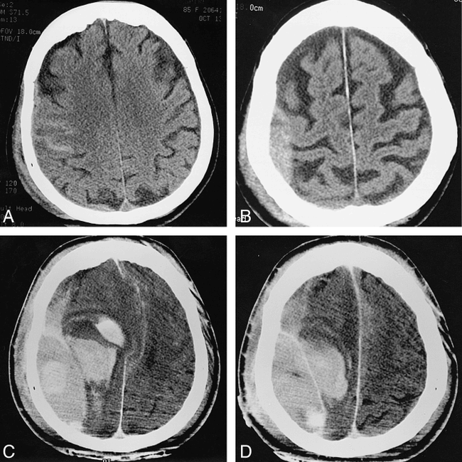 fig 3.