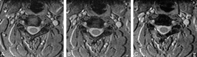 fig 4.