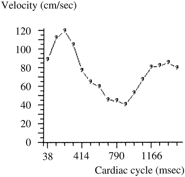 fig 2.