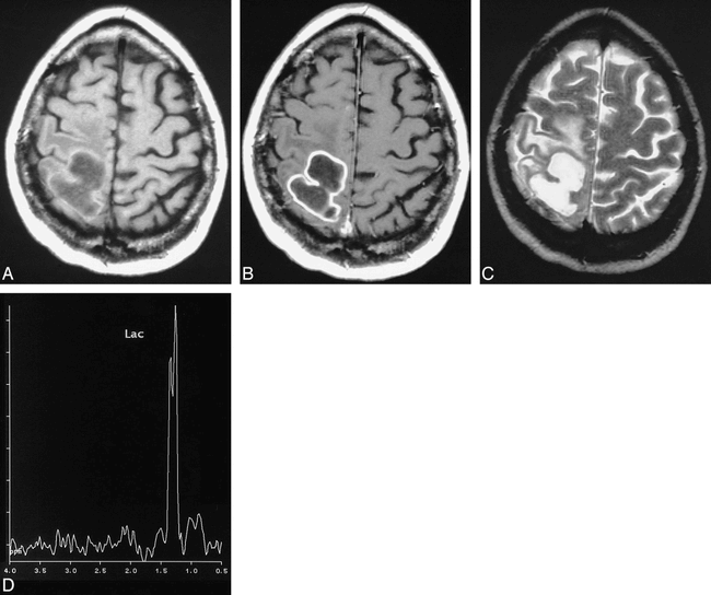 fig 1.