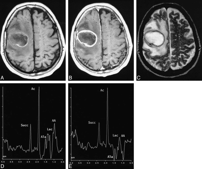 fig 2.