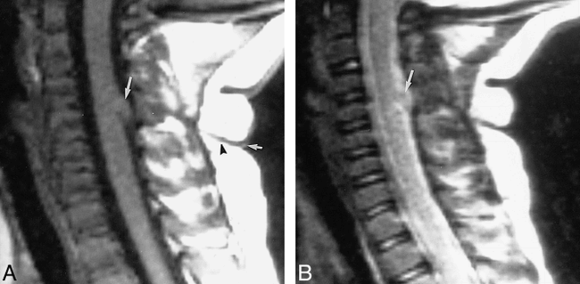 fig 2.