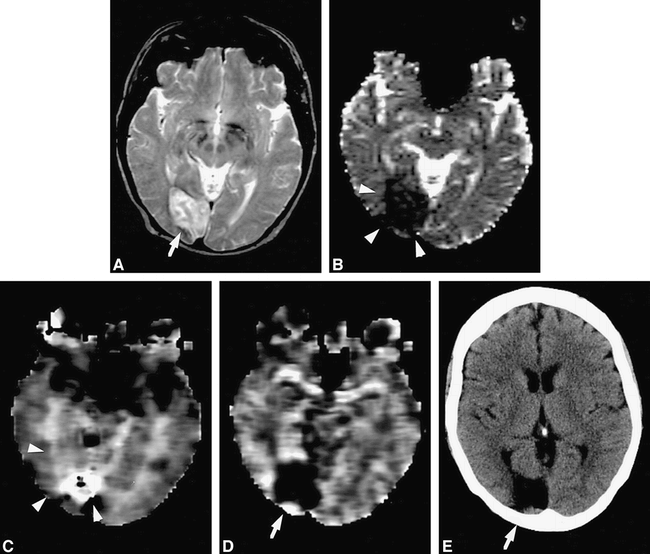 fig 1.