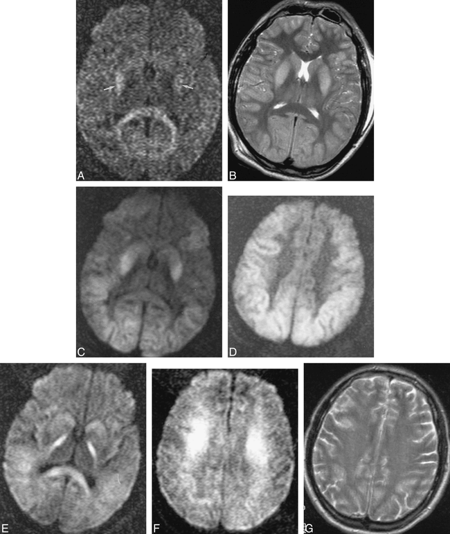 fig 2.