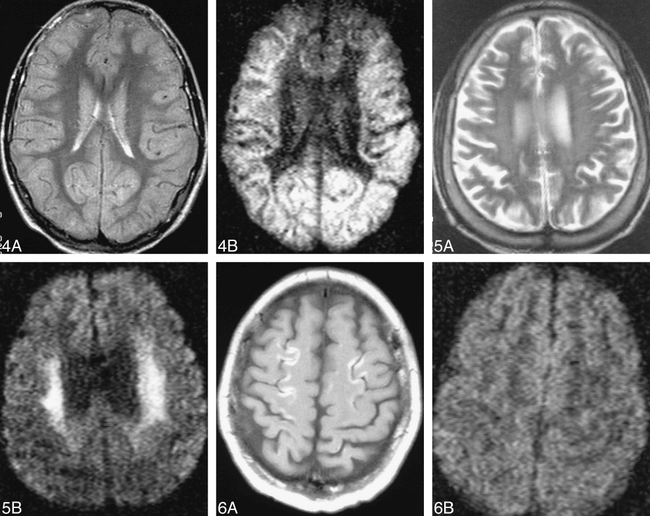 fig 4.