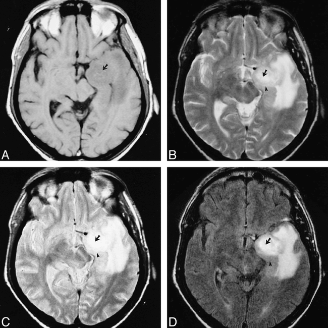 fig 3.