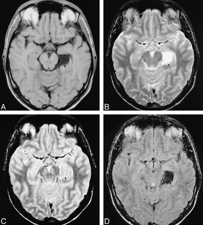 fig 6.