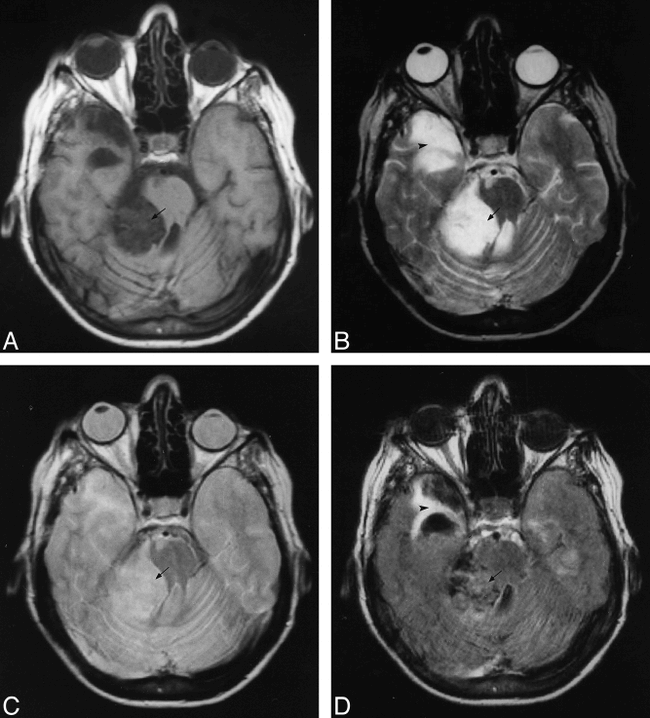 fig 7.