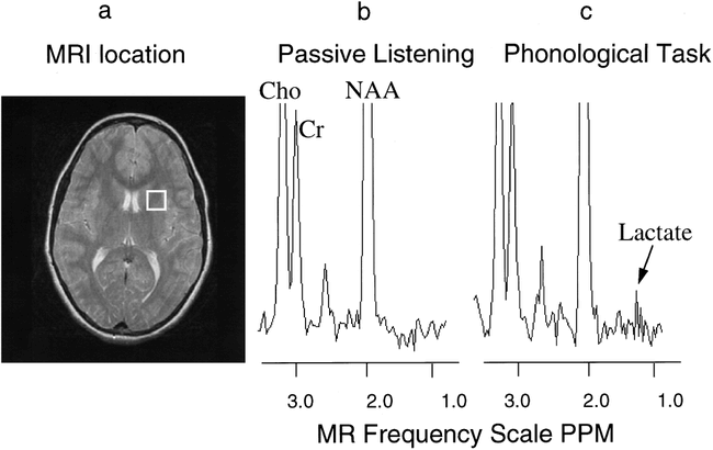 fig 2.
