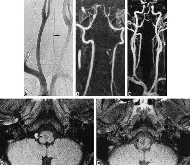 fig 4.