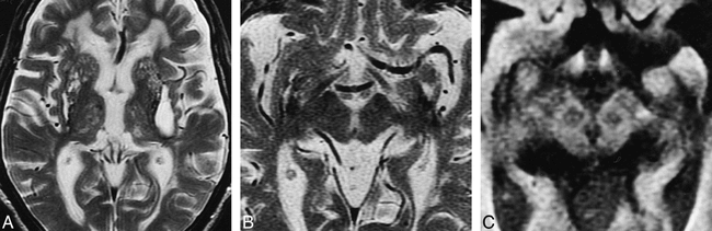fig 6.