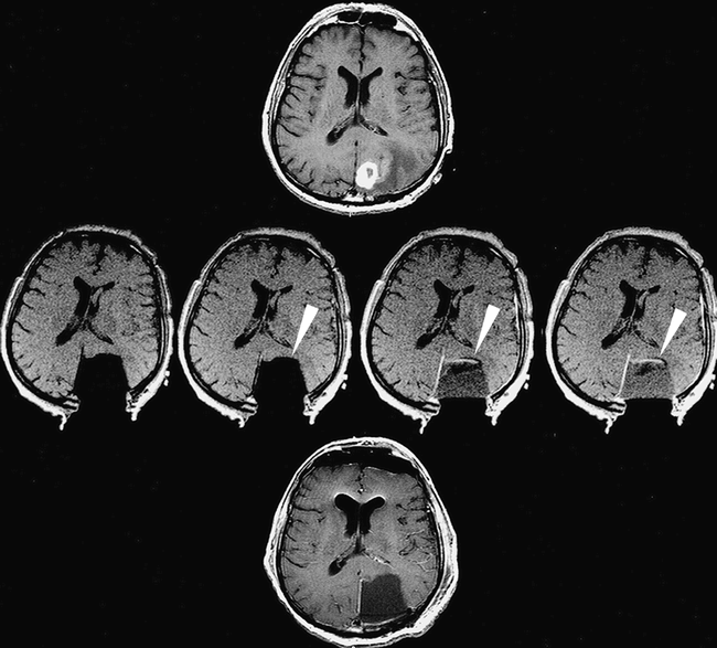 fig 3.
