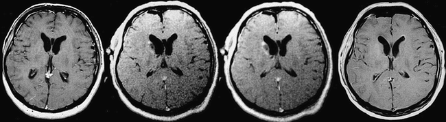 fig 8.