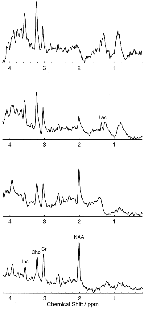 fig 3.
