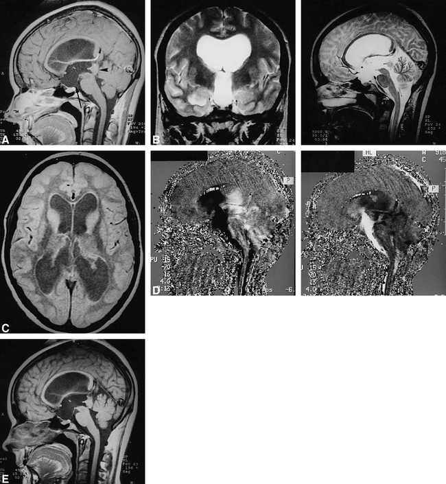 fig 1.