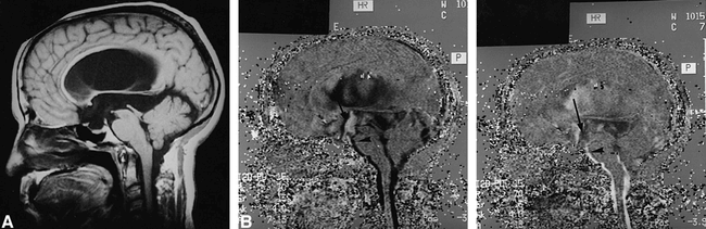 fig 5.