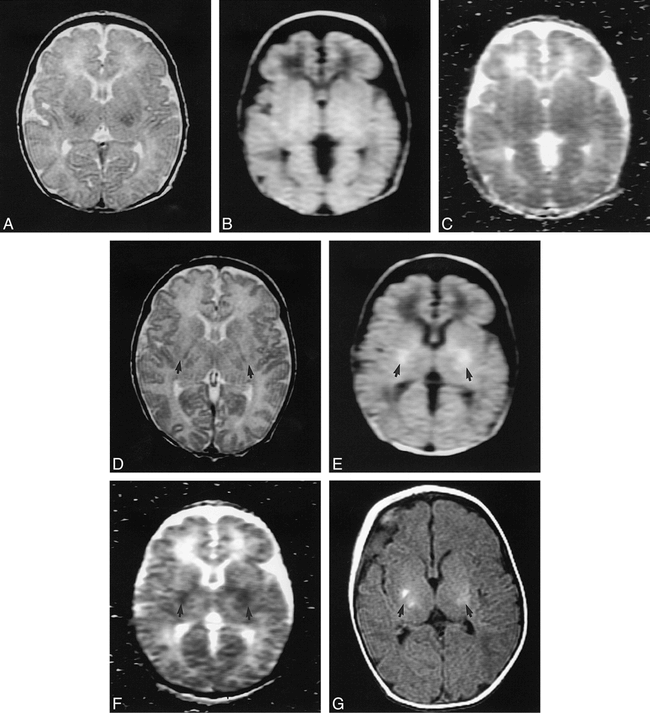 fig 1.