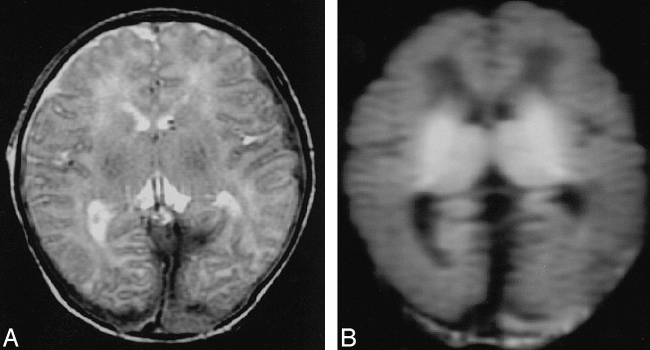 fig 3.