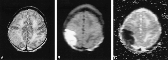 fig 4.