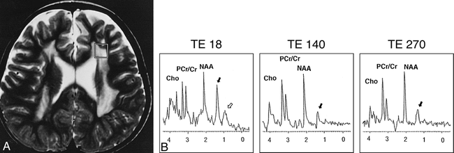 fig 1.