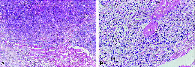 fig 4.