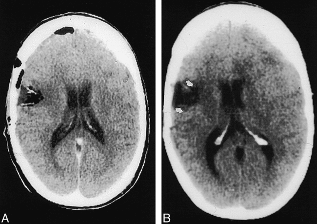 fig 3.