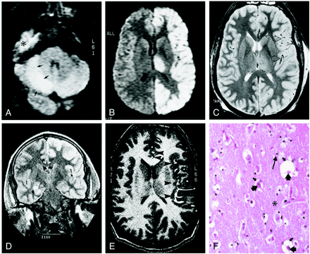fig 1.