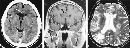 fig 1.
