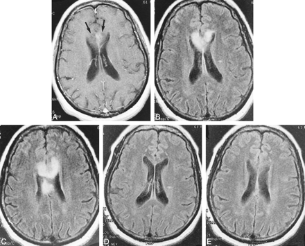 fig 2.