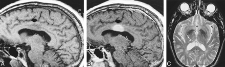 fig 3.