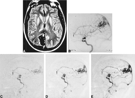 fig 5.