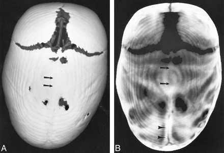 fig 2.