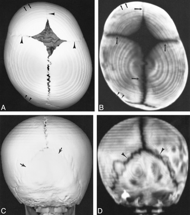 fig 3.