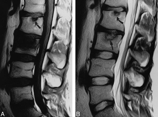 fig 3.