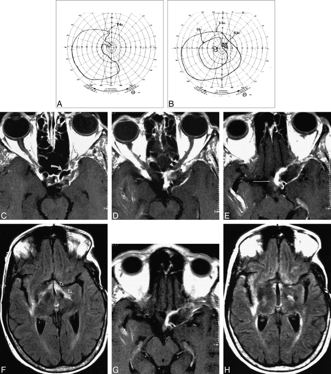 fig 2.