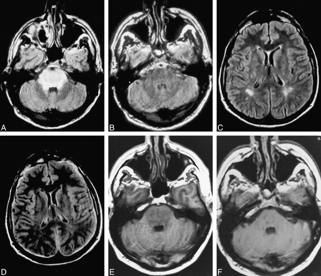 fig 1.
