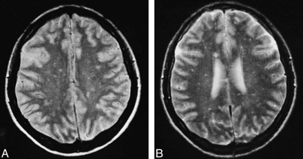 fig 2.
