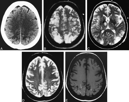 fig 1.