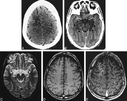 fig 2.