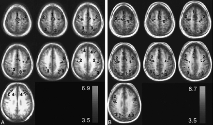 fig 1.